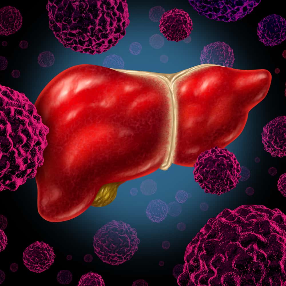 síntomas de que te has contagiado de hepatitis C y aún no lo has DESCUBIERTO Familias